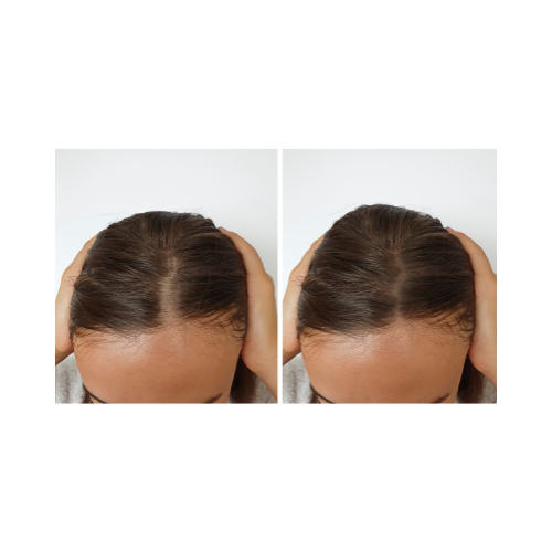 <span data-mce-fragment="1">This Hair Growth Oil combines 15+ oils with the natural powers of rosemary and fenugreek to promote healthy hair growth. Expertly crafted with scientifically proven ingredients, this oil nourishes and strengthens strands from root to tip. Transform your hair with this potent blend of botanicals.</span> Designed to have your hair looking amazingly healthy and shiny.&nbsp;<br data-mce-fragment="1">